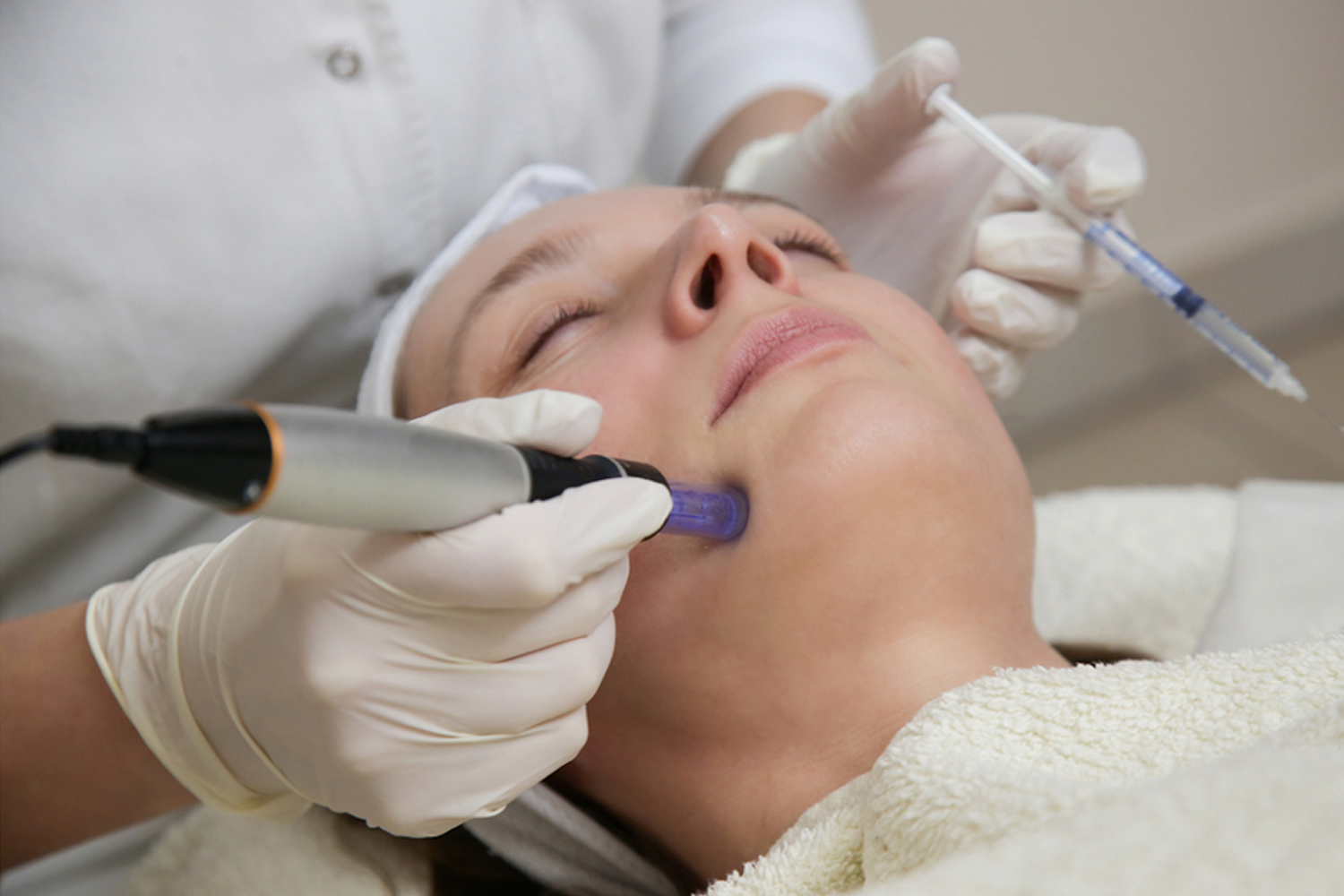 Micro Needling 04